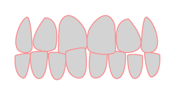 Dientes Cruzados