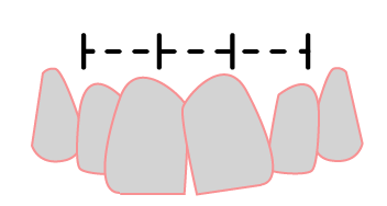 Dientes Torcidos