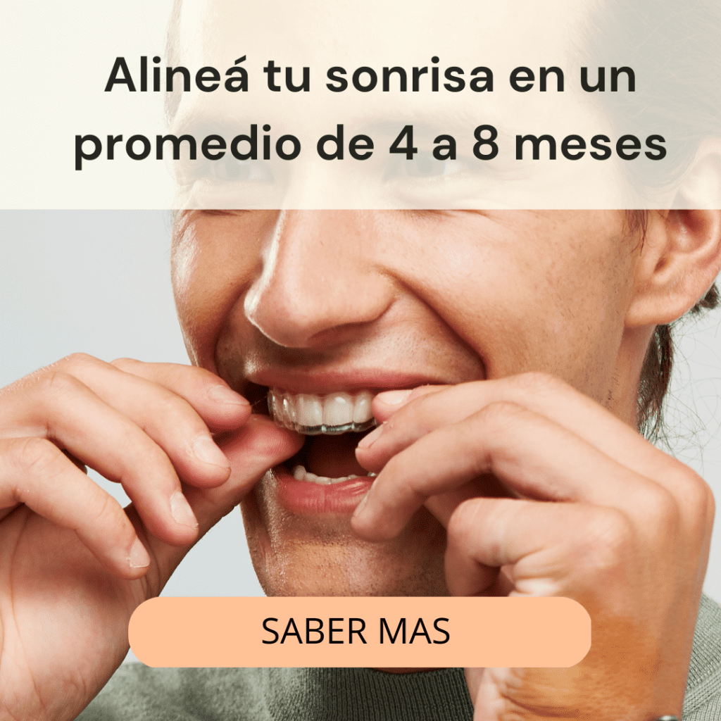 Banner_en_blog_Alineadores_invisibles_dientes_alineados_en_8_meses