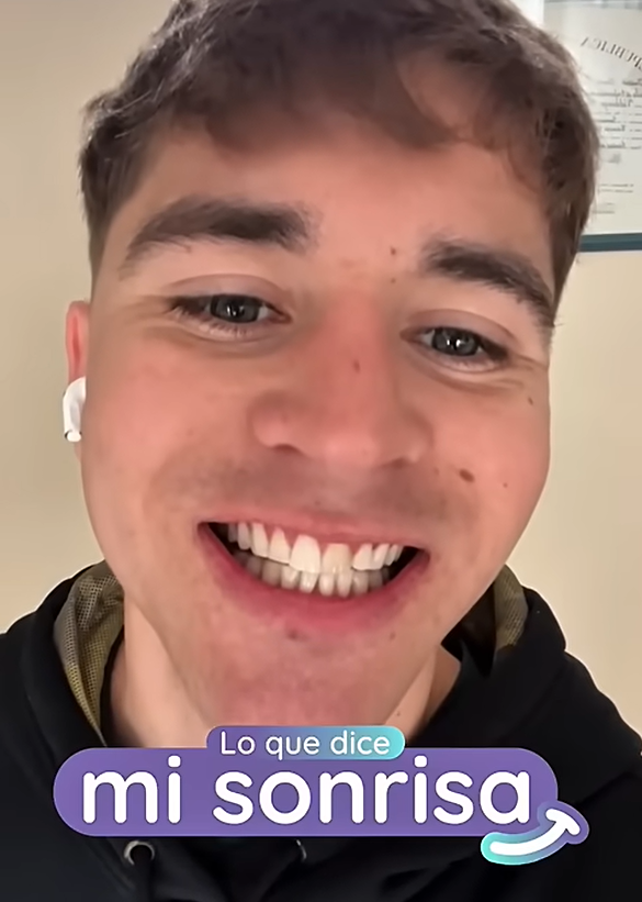 Facundo Hernandez cuenta su experiencia con Glow Up